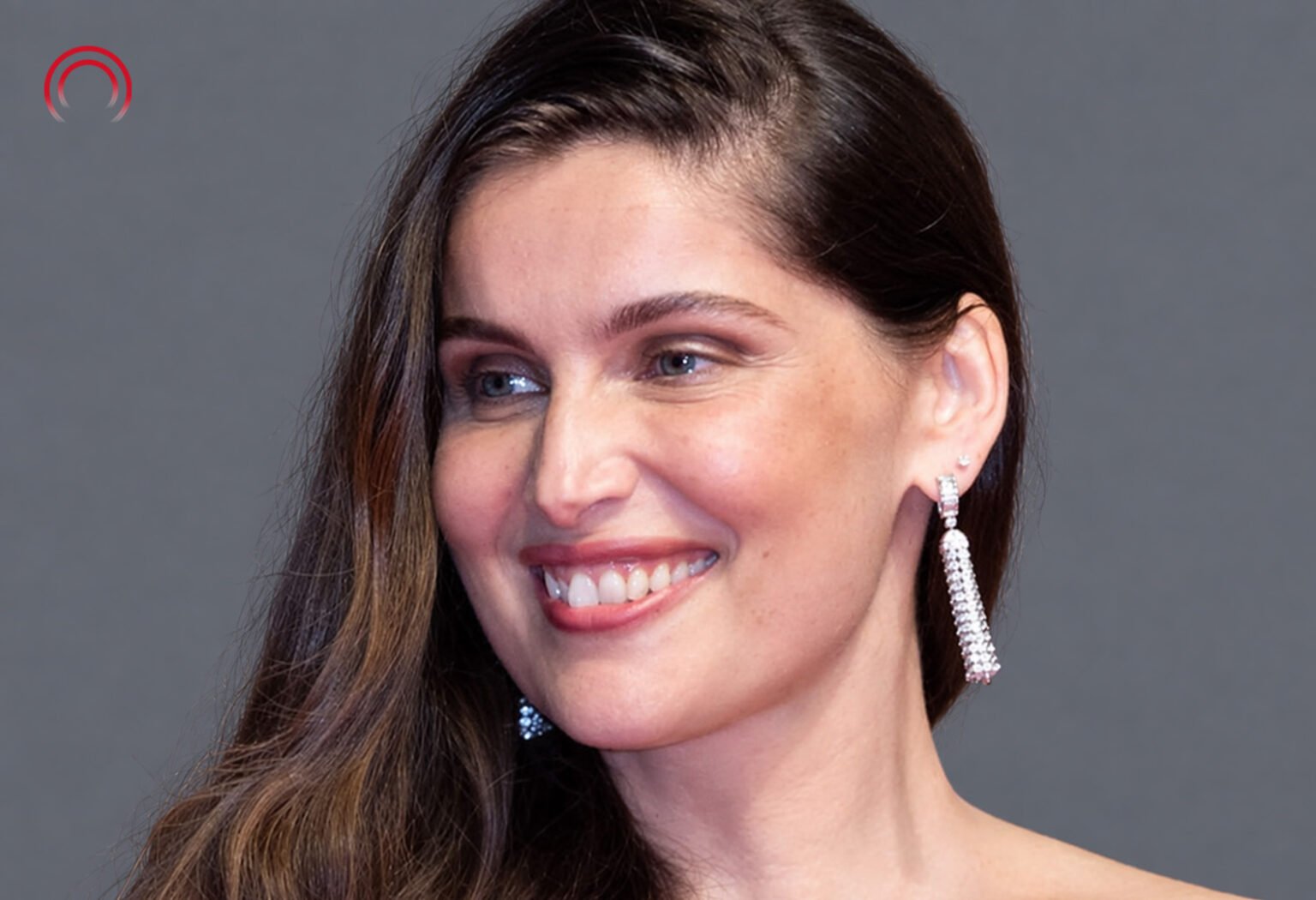 orthodontie laetitia casta dents